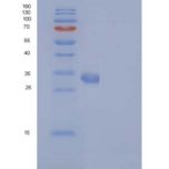 小鼠IL17RA / IL17R / CD217重组蛋白His tag