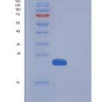 人MANF / ARMET重组蛋白His tag