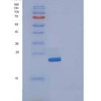 人白介素19(IL19)重组蛋白His tag