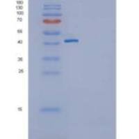 人GITR / TNFRSF18重组蛋白Fc tag