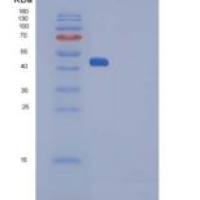 大鼠SerpinF1 / PEDF重组蛋白His Tag