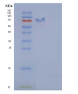大鼠PDGFRB / PDGFR-1重组蛋白Fc tag