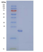 人N6AMT1 / HEMK2重组蛋白His tag