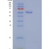 小鼠S100A15 / S100A7A重组蛋白His & MBP tag