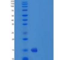 人R-脊椎蛋白3(RSPO3)重组蛋白aa 1-146, His Tag