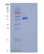 人ACP1 / LMW-PTP重组蛋白GST tag