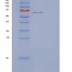 大鼠IL23R / IL2重组蛋白Fc tag