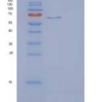 大鼠IL23R / IL2重组蛋白Fc tag