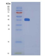 小鼠CTLA4 / CD152重组蛋白Fc tag
