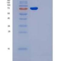 大鼠gp130 / IL6ST / CD130重组蛋白His & Fc tag