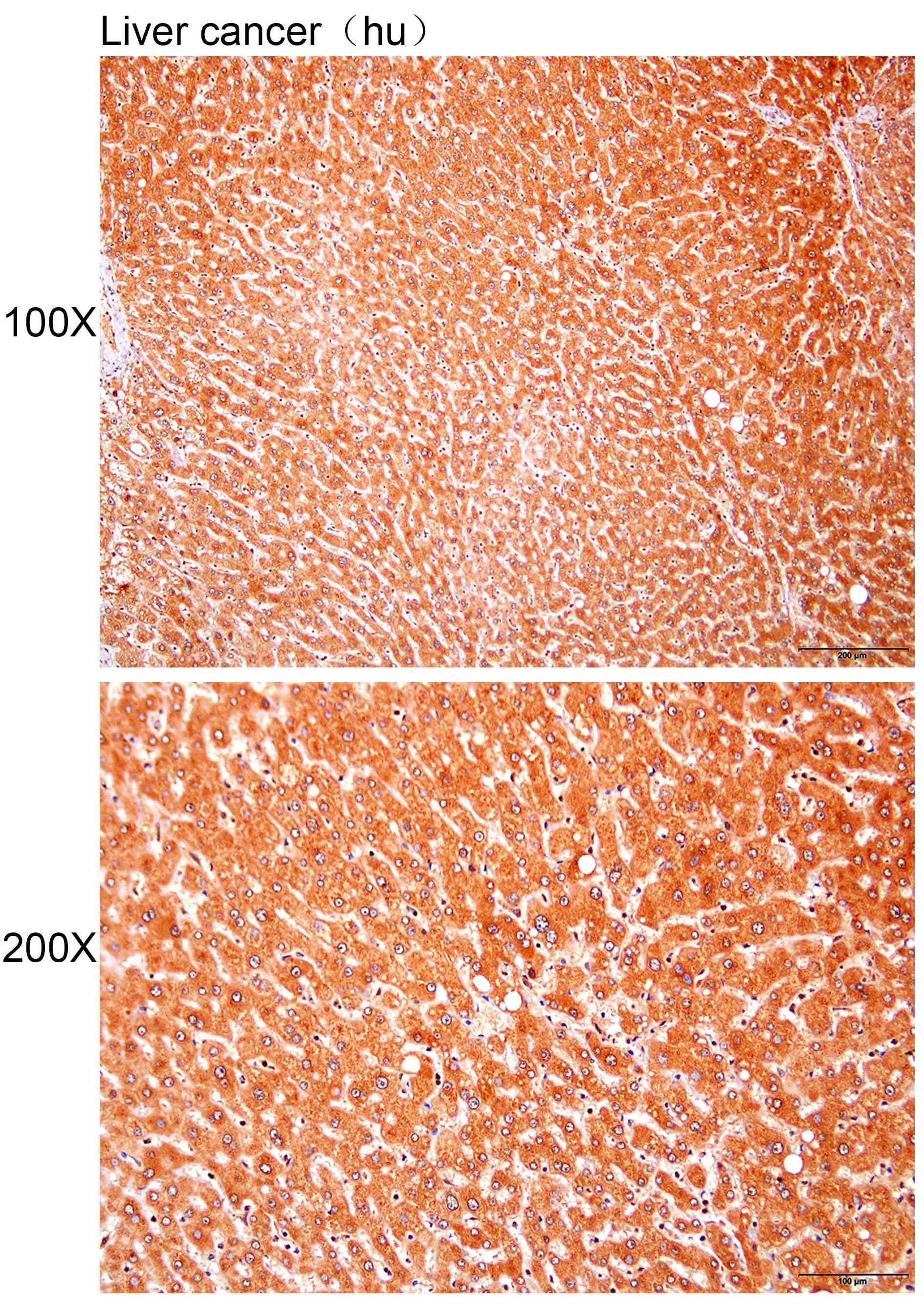 Anti-ADGRG6 Polyclonal Antibod