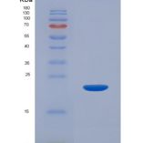 大鼠白介素1β(IL1b)重组蛋白