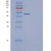 人Ephrin-B1 / EFNB1重组蛋白His & Fc tag