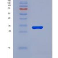 人补体成分5a(C5a)重组蛋白