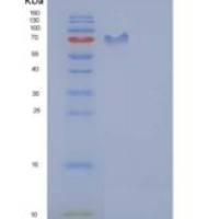 人ICAM-1 / CD54重组蛋白His & Fc tag