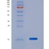 小鼠半乳糖凝集素1(GAL1)重组蛋白