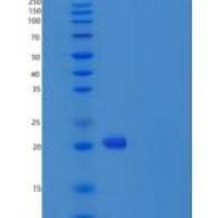 人干扰素α4(IFNa4)重组蛋白His Tag
