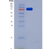 大鼠VEGFR1 / FLT-1重组蛋白His tag
