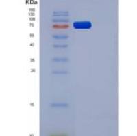 大鼠VEGFR1 / FLT-1重组蛋白His tag