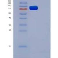 小鼠VEGFR3 / FLT-4重组蛋白His tag