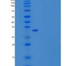 人白介素1β(IL1b)重组蛋白pro form, His tag