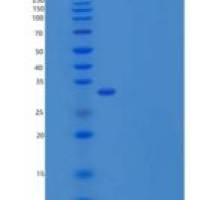 人白介素1β(IL1b)重组蛋白pro form, His tag