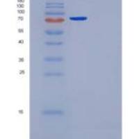 人纤连蛋白/纤连蛋白片段2重组蛋白His tag