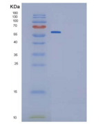 大鼠IL-6R / CD126重组蛋白Fc tag, ECD