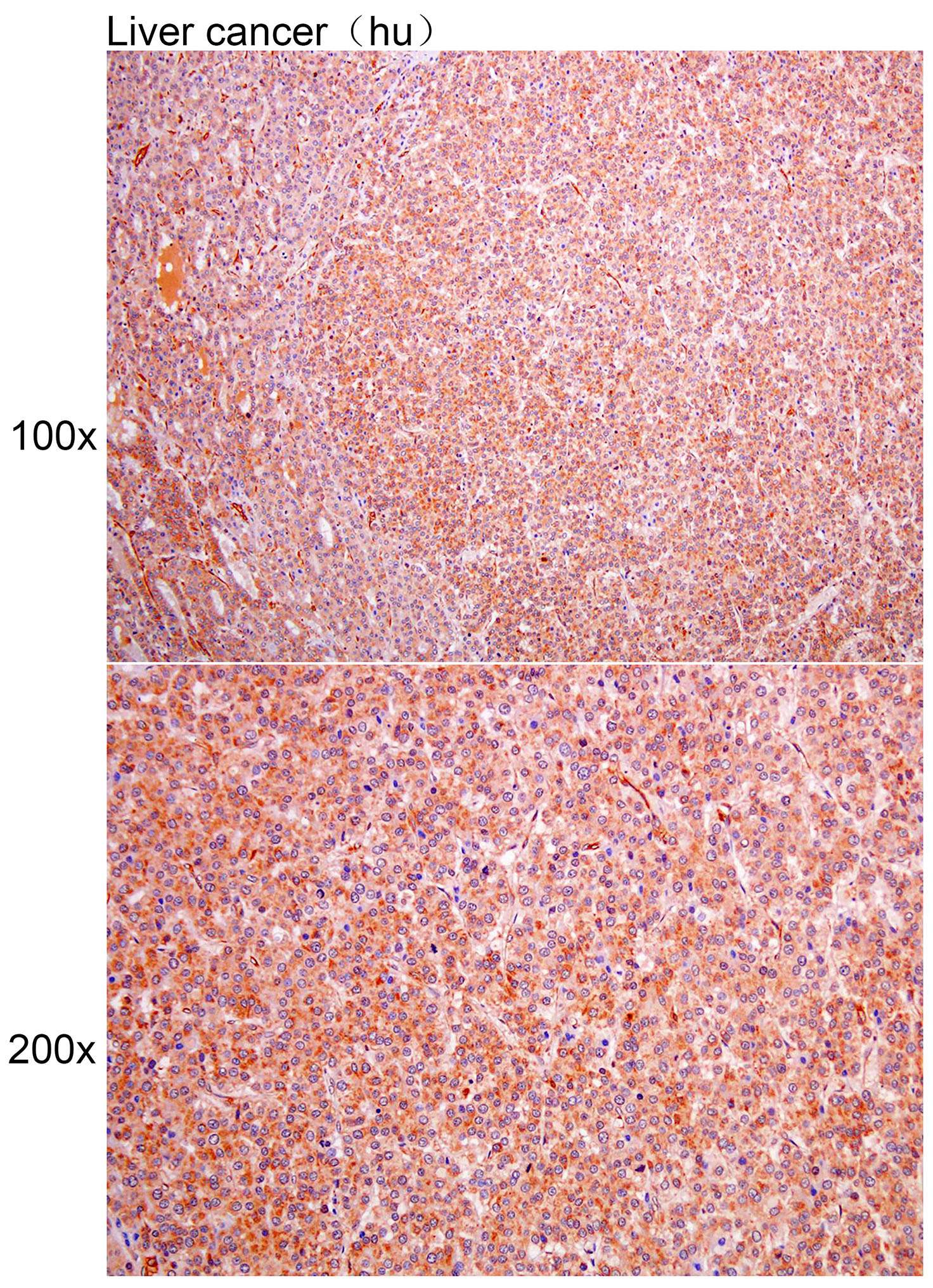 Anti-ADGRG1 Polyclonal Antibod