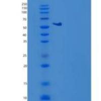 小鼠凝血因子Ⅹ(F10)重组蛋白C-6His