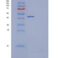人TNFRSF19 / TROY重组蛋白Fc tag