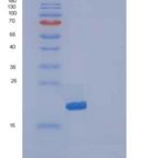 人IL1F5 / IL36RN重组蛋白
