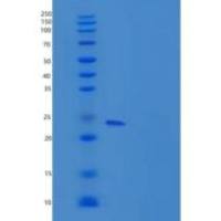 大鼠JAM-A / F11R重组蛋白His tag