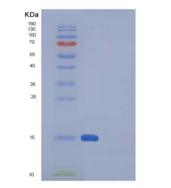 人SNCA/α-突触核蛋白重组蛋白
