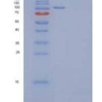 小鼠AARS /丙氨酰-tRNA合成酶重组蛋白His tag