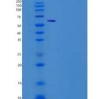 小鼠Granulin / GRN / Progranulin重组蛋白His tag