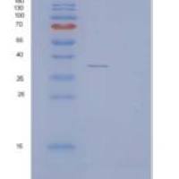 人酰基磷酸酶1(ACYP1)重组蛋白GST Tag