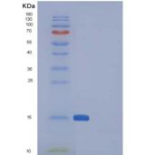 人SNCA/α-突触核蛋白重组蛋白
