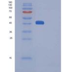 人CTLA4 / CD152重组蛋白His & Fc tag