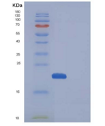 小鼠CDNF / ARMETL1重组蛋白His tag