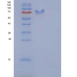 大鼠PDGFRB / PDGFR-1重组蛋白Fc tag