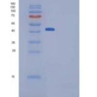 小鼠多效蛋白/ PTN / HB-GAM重组蛋白Fc tag