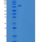 人Endoglin / CD105 / ENG重组蛋白Fc tag