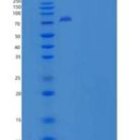 人Endoglin / CD105 / ENG重组蛋白Fc tag