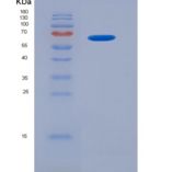 大鼠苹果酸脱氢酶1(MDH1)重组蛋白