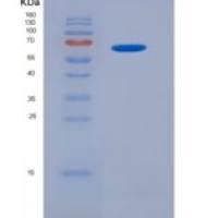 大鼠苹果酸脱氢酶1(MDH1)重组蛋白