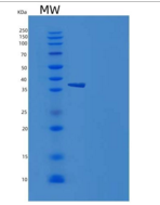人NETO1 / BTCL1重组蛋白His tag