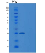 人松弛素-1 / RLN1重组蛋白His tag
