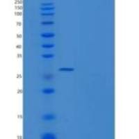 人METTL1重组蛋白His tag