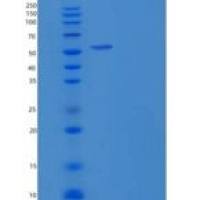 人黑素瘤缺乏因子2(AIM2)重组蛋白GST tag